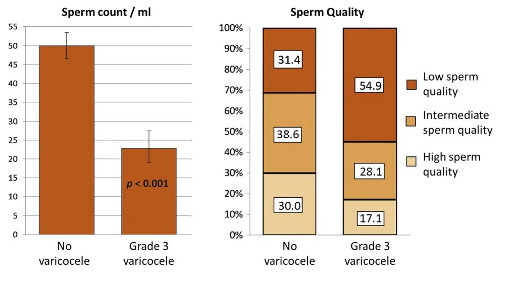 Varicocele And Fertility Fertility SCIENCE Varicocele And Fertility Fertility SCIENCE